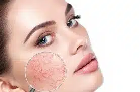 روتین پوستی چیست؟ 
