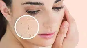 روتین پوستی چیست ؟