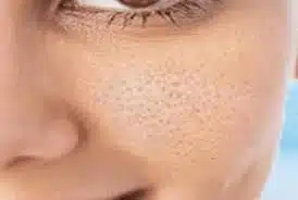 منافذ باز پوست