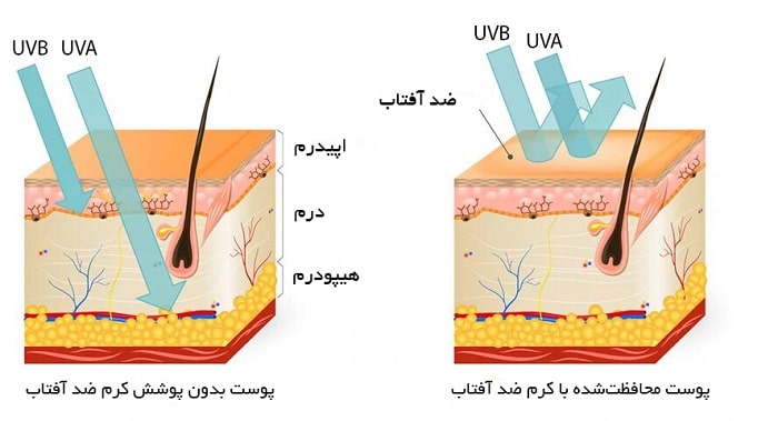 UVA و UVB چه تفاوتی دارند؟